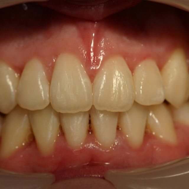 Customer 2 | Teeth After