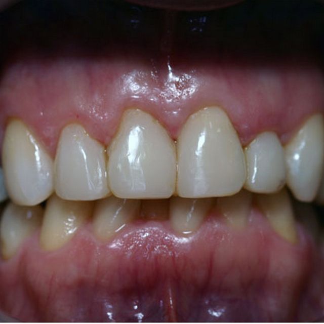 Customer 4 | Teeth After